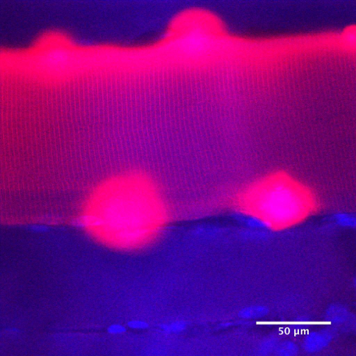 Magnified image of skeletal muscle fibre electroporated with a recombinant dye